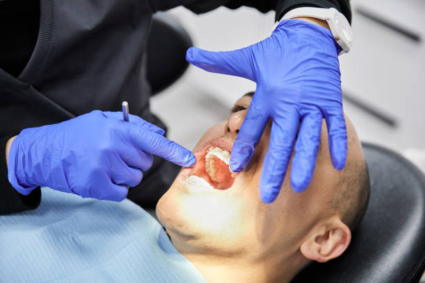 Best Chipped Tooth Repair Near Me  in Lliams Bay, WI