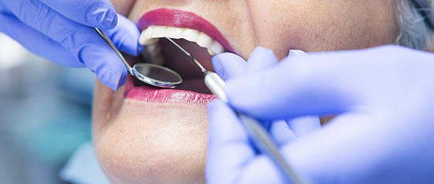 Best Knocked-Out Tooth Emergency  in Lliams Bay, WI